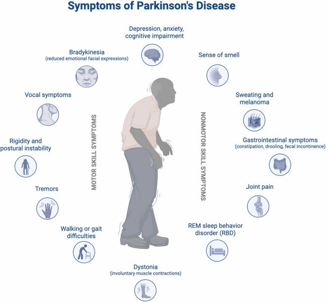 Common Parkinsonian motor symptoms