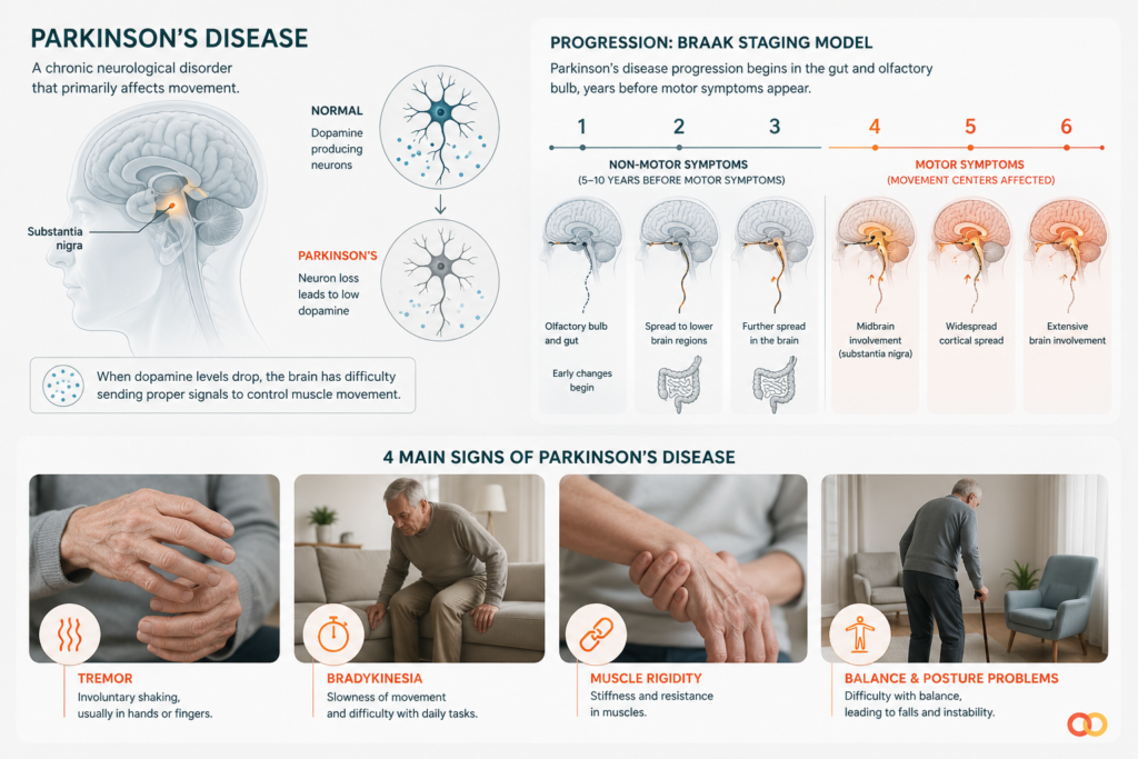 4 main signs of Parkinson's disease
